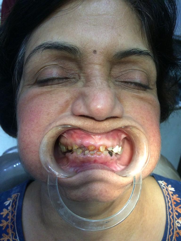 Dantshree Dentist in pashan